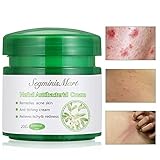 Psoriasis Creams,Psoriasis Treatment,Psoriasis Creams for Dermatitis, Eczema, Chinese Herbal Cream Pruritus Psoriasis Ointment