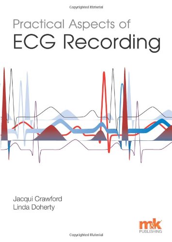 BEST! Practical Aspects of ECG Recording [W.O.R.D]