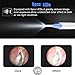 CSHope Ear Endoscope, WiFi Otoscope, Wireless Ear Endoscope with 1.3MP, Anti-Scald HD Visual Inspection Earwax Cleaning Borescope, 6 LED Lights, Suitable for Android, iOS, Tablet- (Not for Computer)