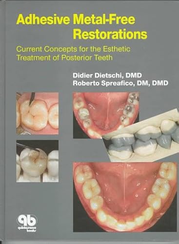 Download Adhesive Metal-Free Restorations: Current Concepts for the Esthetic Treatment of Posterior Teeth PDF