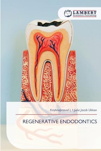 ITI Treatment Guide: Implant Therapy in the Esthetic Zone for