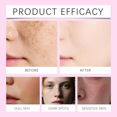 7% Arbutin & 4% Tranexamic Acid Brightening Cream - Professional Dark Spot Corrector & Hyperpigmentation Treatment - For Melasma & Post-Acne Marks 50ml