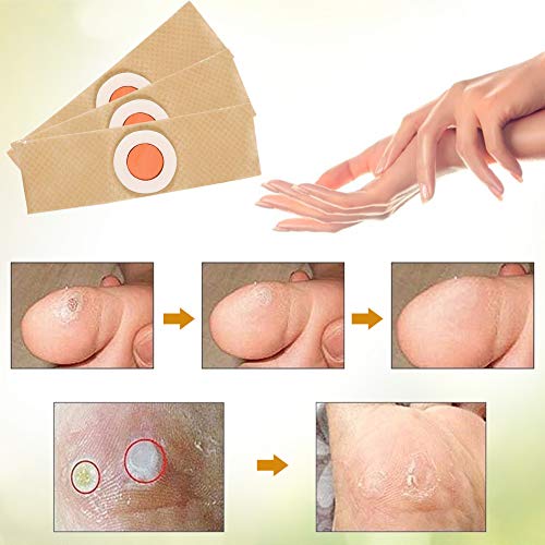 Corn Remover Pads, Corn Removal, Wart Removal, It is a Better Solution for People Who Suffer The Pain of Corn, Wart & Callus, 24Pcs/Box