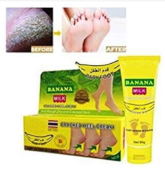 amazon cracked heel cream