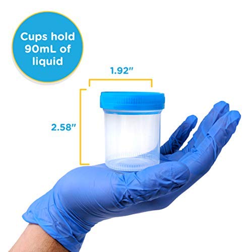 2 Urine+Specimen+Collection+Cups+Lids