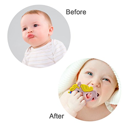 image for RonXer Baby Teething Toy Unicorn Teether Massage, Molar Teeth Soother 