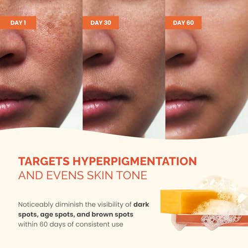 PLANTIFIQUE Kojic Acid & Turmeric Soap – Lab Tested – 4 Bars with Mesh Bag for Dark Spots & Hyperpigmentation – Face Wash with Vitamin C, Hyaluronic Acid & Collagen, 320 g