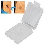 30Pcs Skin Tag Removal Rubber Bands, Skin Tag