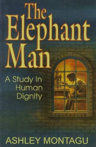 The Elephant Man : A Study in Human Dignity