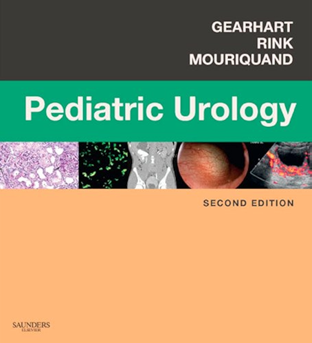 Download Pediatric Urology E-Book (Expert Consult Title: Online + Print) (English Edition) PDF