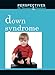 Down Syndrome (Perspectives on Diseases and Disorders)