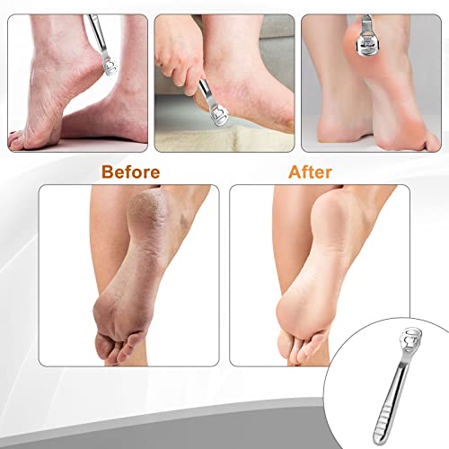 Foot File Pedicure - Foot File Care Tool Stainless Steel Razor Hard Callus Grater Corn Cutter Hard Dead Skin - Professional Pedicure Tool Kit with 10 Blades, Silver