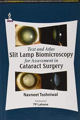 Text and Atlas: Slit Lamp Biomicroscopy for Assessment in Cataract Surgery