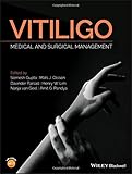 Vitiligo - Medical and Surgical Management