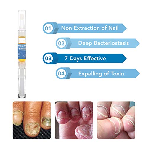 Arishine Nail Repair Pens for Toenail and Fingernail, Maximum Strength
