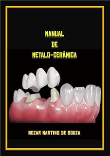 Livro Manual de Metalo-Cerâmica: Prótese Odontológica