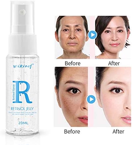 Oyalaiy Retinol Gel Moisturizing Firming Skin Smooth Fine Lines Lighten The Skin Color Anti-Aging Facial Essence