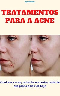 Livro Tratamentos para a acne: Combata a acne, cuide do seu rosto, cuide da sua pele a partir de hoje