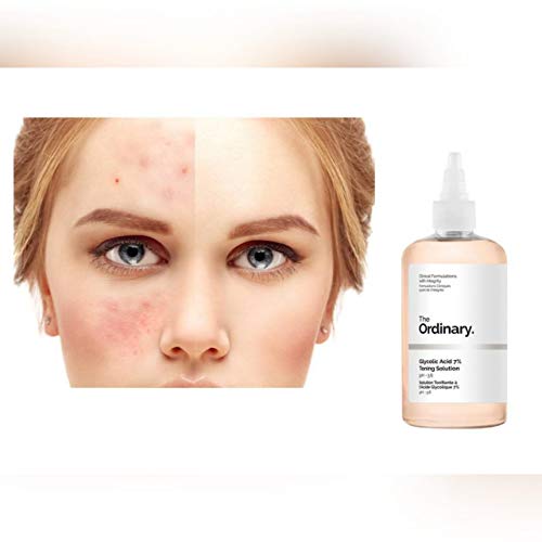 glycolic toning solution ordinary