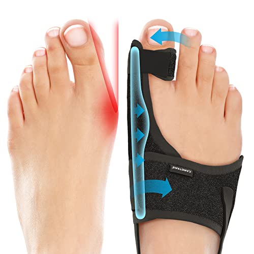 Caretras 2-Pack Bunion Corrector for Women & Men, Orthopedic Bunion Splint for Hallux Valgus Pain Relief, Big Toe Separator, Adjustable Day/Night Support, Comfortable Hammer Toe Straightener