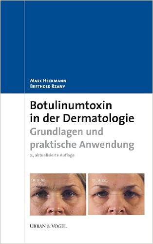 Botulinumtoxin In Der Dermatologie Grundlagen Und Praktische Anwendung Amazon De Heckmann Marc Rzany Berthold Bucher