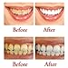 Alelife Toothpaste, Powerful Stain Removal Whitening Toothpaste Fight Bleeding Gums Toothpaste (Blueberry)
