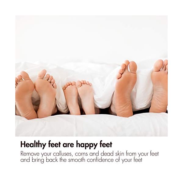 Revitale Natural Volcanic Lava Pumice Foot Stone - Pedicure Scrubber & Hard Dead Skin/Callus Remover