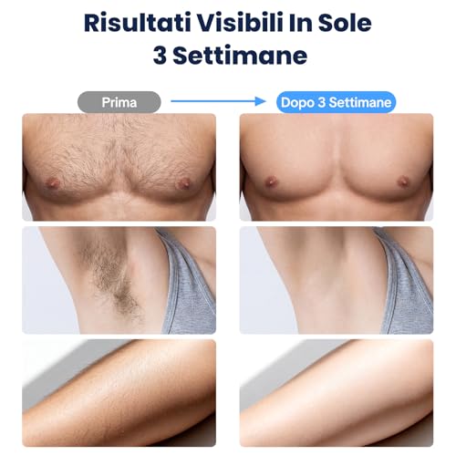 MANKIW IPL Epilation Device with Cooling Function, 5 Energy Levels & 500,000 Luminous Pulses, Automatic and Manual Mode, Alternative to Laser Hair Removal, Legs, Armpits and Bikini