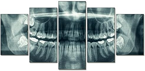 Mivyy- 5 Pcs/Set HD Stretched and Wood Framed Print 5 Unids Modern Home Canvas Art X-Ray Dental Tooth Painting Wall Decor Art for Room Ready to Hang