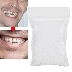 Temporary Tooth Repair Beads For Missing Tooth