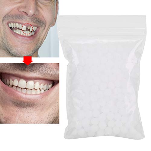 Temporary Tooth Repair Beads For Missing Tooth