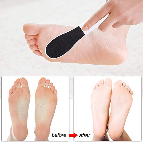 Somaer Pedicure Foot File, Double-Sided Colossal Foot Rasp and Callus Remover Best Foot Care Pedicure Plastic Surface Tool to Remove Hard Skin(Pack of 5)