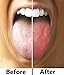 Tongue Scraper, Ayurvedic Tongue Cleaner (Pack of 2) Pure Copper Metal Tongue Brush Sweeper for Daily Oral Dental Hygiene Fresh Breath and Health + Cotton Pouch