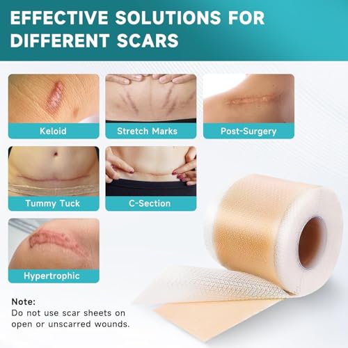 Silicone Scar Dressing 4 cm x 300 cm, Reusable Self Adhesive Silicone Band, Cuttable, Thin and Flexible, Comfortable for Different Body Areas