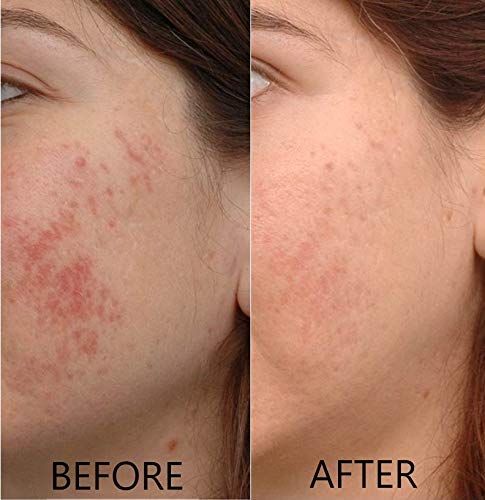 timeless vitamin c before and after