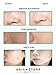 Aria Starr Anti Acne Treatment Serum & Pores Minimizer - BEST For Face, Stubborn Acne, Blackheads & Blemishes -1fl oz