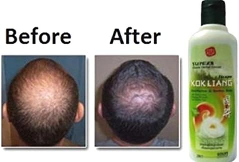 2x200ml Kokliang Kok Liang Herbal Shampoo Anti hairloss/soothes scalp/dandruff