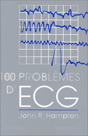 Telecharger 100 Problemes D Ecg Pdf De J R Hampton Nhanobnewsi