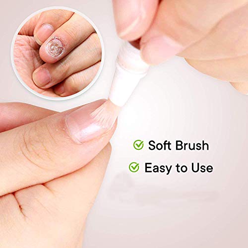 St. Mege, Fungus Stop Fungus Nail Repair Pen 4 Pens included,Natural Fungal Nail Care Solution for Fingernails and Toenails, Perfect for Strengthening Unhealthy Nails         - Thumbnail 3
