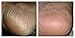 Foot Repair Serum - Eliminates Dry, Cracked Heels Fast! More concentrated than any creams, heel sticks or lotions!