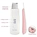 Arsty Facial Ultrasonic Skin Scrubber Spatula Facial Extractor & Exfoliation Blackhead Removal (PINK)