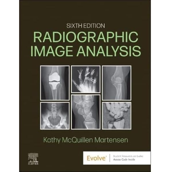 Digital Radiography and PACS: Carter MSRS RT(R), Christi, Veale