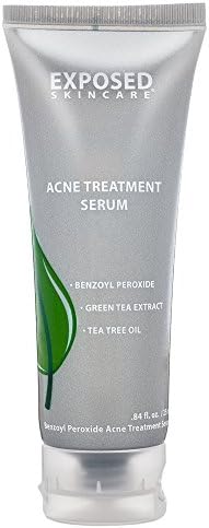 Travel Size Acne Day Treatment Serum by Exposed Skin Care, Benzoyl Peroxide 3.5% Mild Cystic Acne Treatment Serum for Teens and Adults .84 ounces