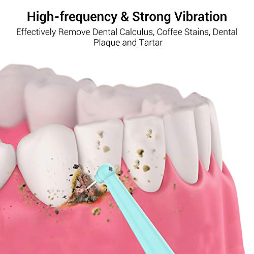 Electric Tartar Remover for Teeth, NICARE Plaque Remover for Teeth