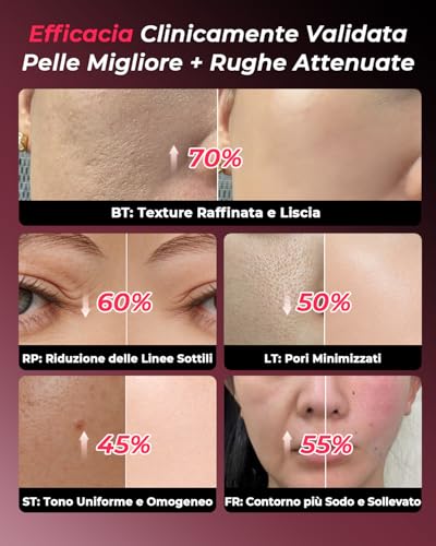 Professional Radiofrequency Face, Clinically Proven Effectiveness, Microcurrent Facial Massager, Anti-Wrinkle, Anti-Aging, Anti-Acne, Lifting and Firming for Face and Neck