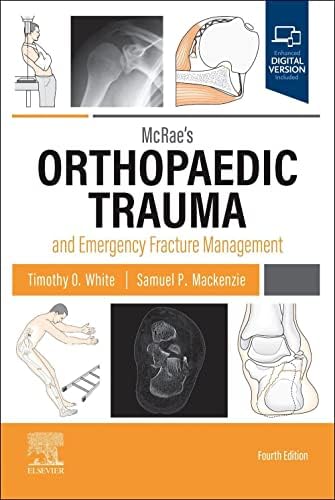 AO Principles of Fracture Management: 9781588905567: Medicine