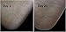 Foot Repair Serum - Eliminates Dry, Cracked Heels Fast! More concentrated than any creams, heel sticks or lotions!