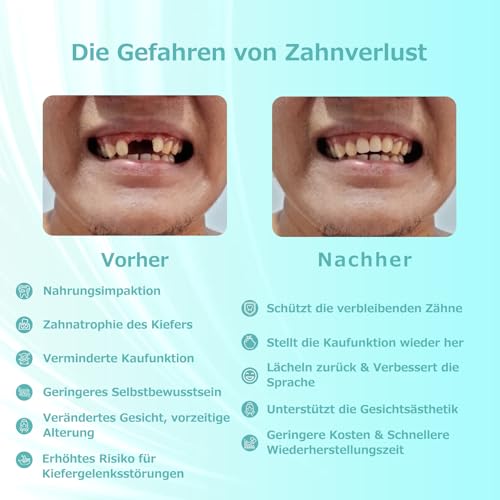 Custom Partial Denture for Dental Spaces - Removable Provisional Denture for Men & Women, Dentures with Perfect Fit Easy to Use for a Perfect Smile (2 Teeth)