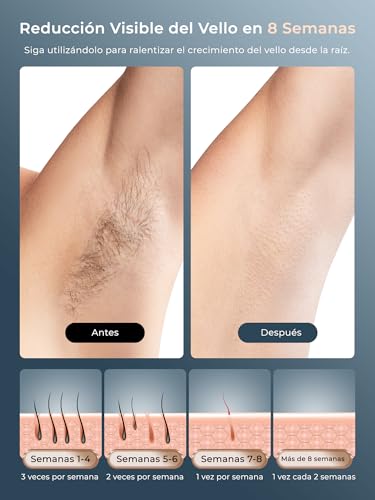21J Laser Epilator with Cooling Function, 600-1200NM Pulsed Light Epilator with 9 Energy Levels, LCD Touch Screen for Women and Men, Bikini, Armpits, Face, White Body