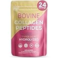 Healthy Living Proteins - Hydrolyzed Bovine Protein Collagen Type I & III - Unflavored Collagen Powder - Grass Fed, Pasture Raised Bovine Peptides - Keto & Paleo, Gluten Free (10 oz (Pack of 1)